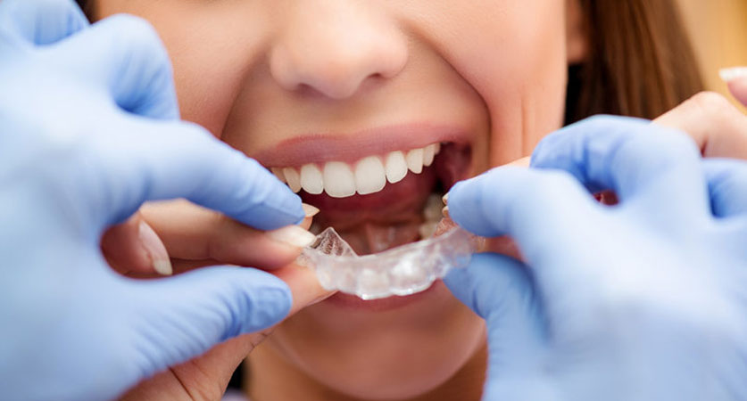 Invisalign Orthodontists