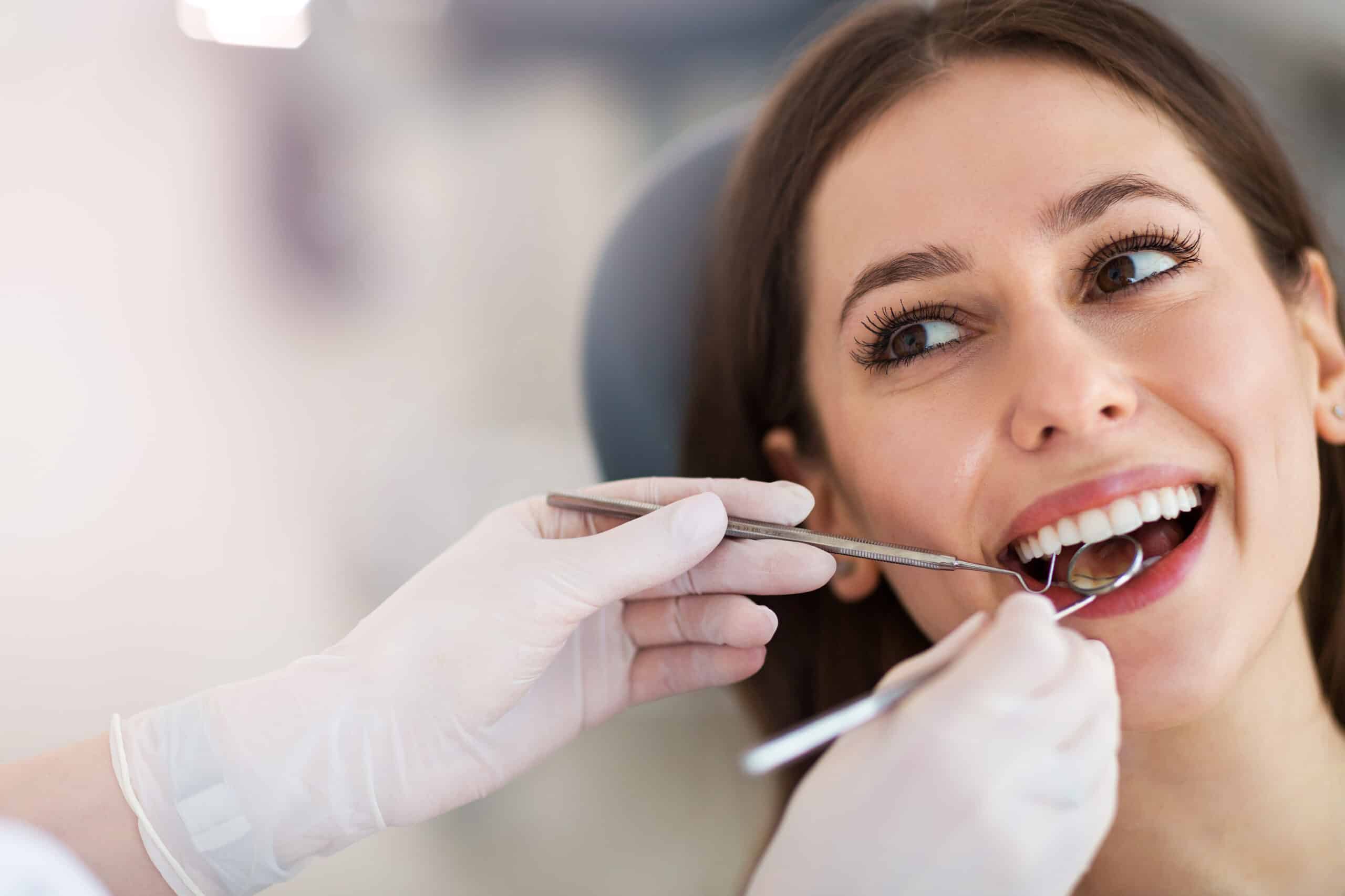 dental bonding cost in Houston