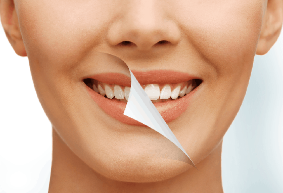 teeth whitening services near me