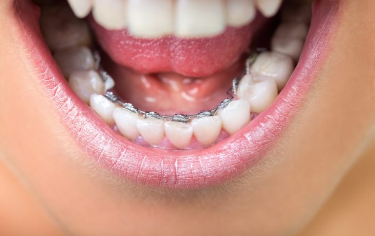 dental_image