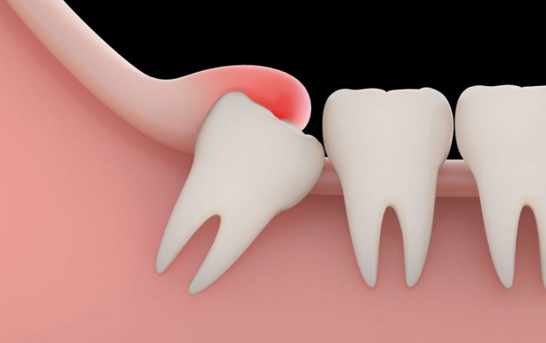 dental_image